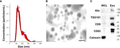 Anti-Viral Activities of Umbilical Cord Mesenchymal Stem Cell-Derived Small Extracellular Vesicles Against Human Respiratory Viruses